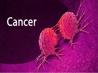 Định nghĩa & cách phát âm từ cancer
