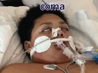 Định nghĩa & cách phát âm từ coma