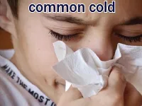 Định nghĩa & cách phát âm từ common cold
