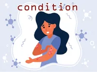 Định nghĩa & cách phát âm từ condition