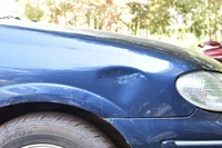 Định nghĩa & cách phát âm từ dent
