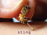 Định nghĩa & cách phát âm từ sting