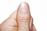 Định nghĩa & cách phát âm từ thumbnail